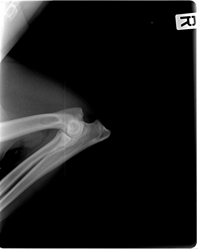 Roentgebilder Gutachten mit 12 Monaten (5)